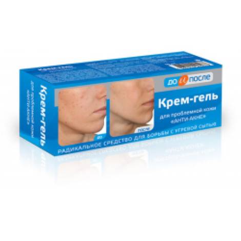 До и после 50,0 Анти-акне крем